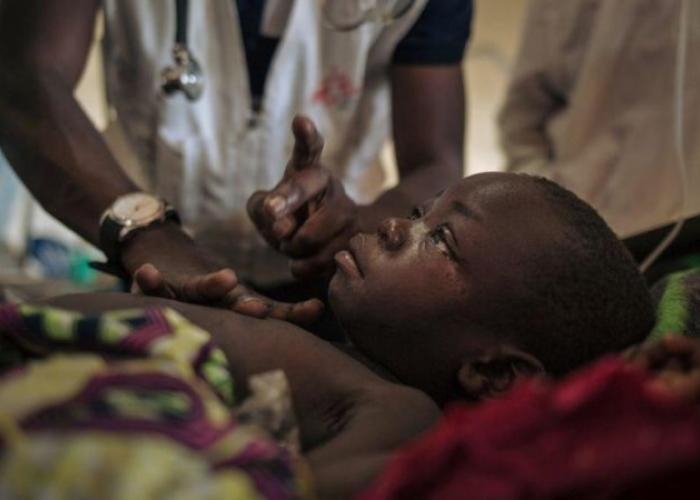 Nord-Kivu : 36 cas suspects de la rougeole détectés dans six zones de santé depuis janvier 2024